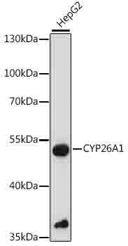 CYP26A1 Rabbit Polyclonal Antibody (CAB16259)