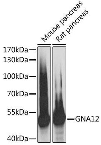 Anti-GNA12 Antibody (CAB13740)
