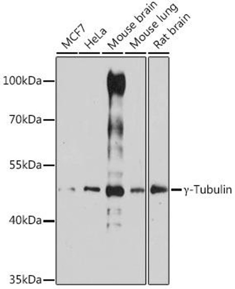Anti-Gamma-Tubulin Antibody (CAB14554)