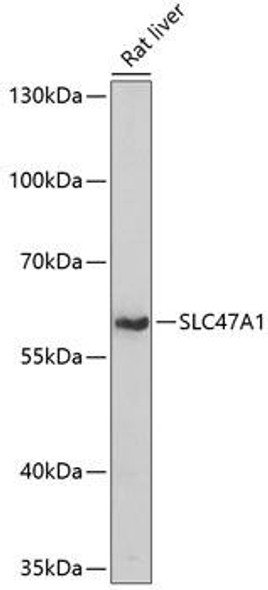Anti-SLC47A1 Antibody (CAB14559)