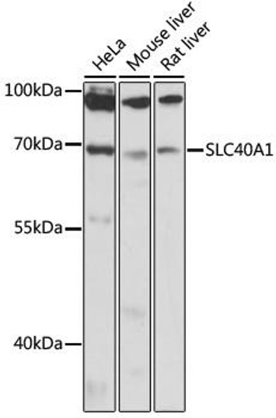 Anti-SLC40A1 Antibody (CAB14884)