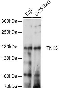 TNKS Rabbit Polyclonal Antibody (CAB17027)