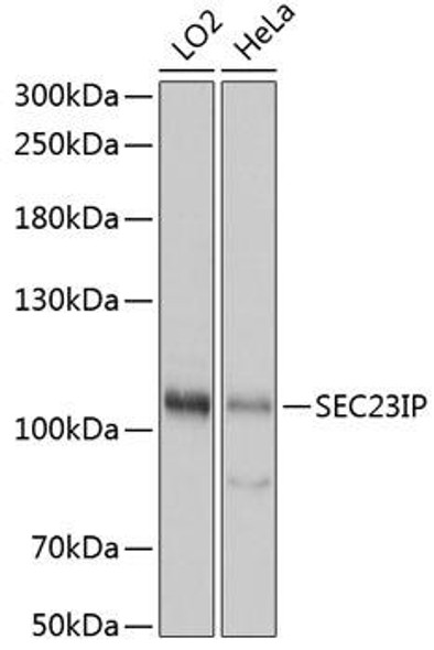 Anti-SEC23IP Antibody (CAB15398)