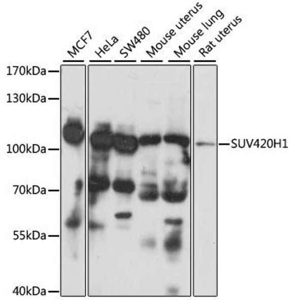 Anti-SUV420H1 Antibody (CAB15442)