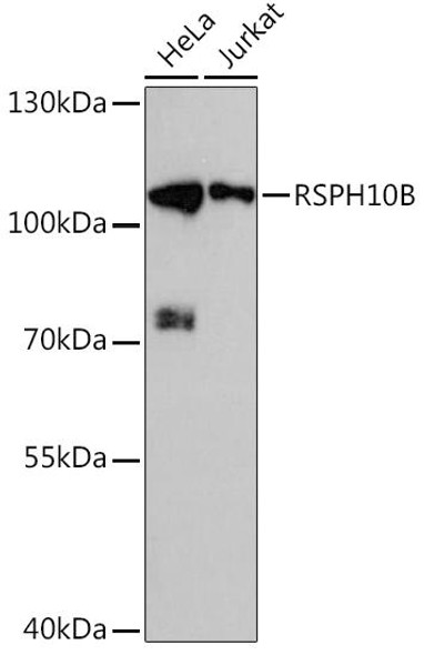 Anti-RSPH10B Antibody (CAB16196)