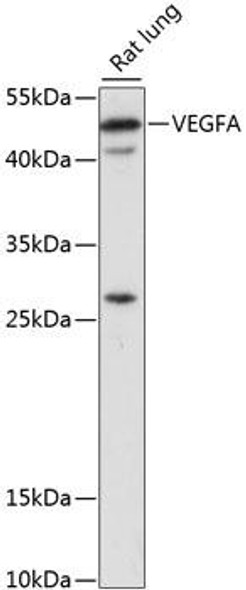 Anti-VEGFA Antibody (CAB16703)