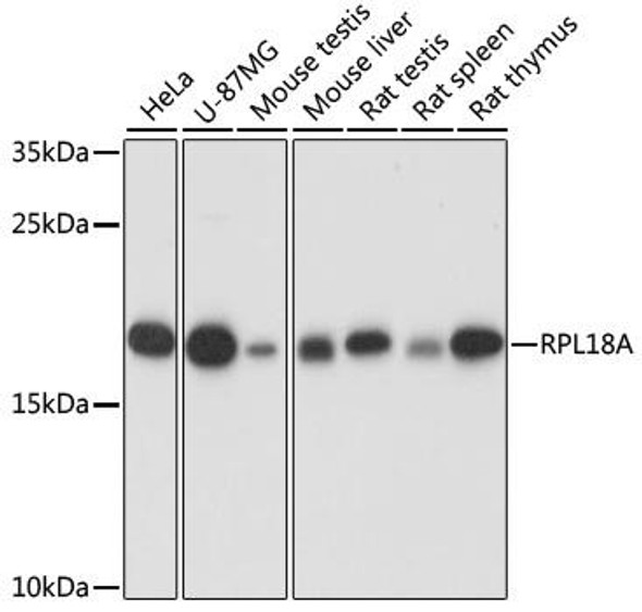 Anti-RPL18A Antibody (CAB16967)