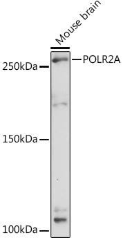 POLR2A Rabbit Polyclonal Antibody (CAB2107)