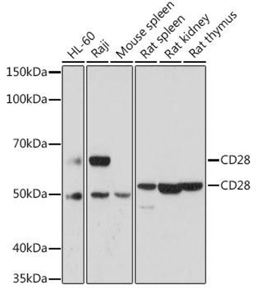 Anti-CD28 Antibody (CAB17447)