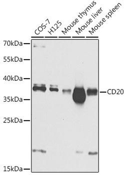 Anti-CD20 Antibody (CAB1793)