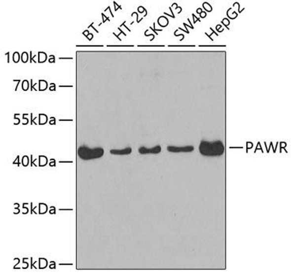 PAR4 Rabbit Polyclonal Antibody (CAB3063)