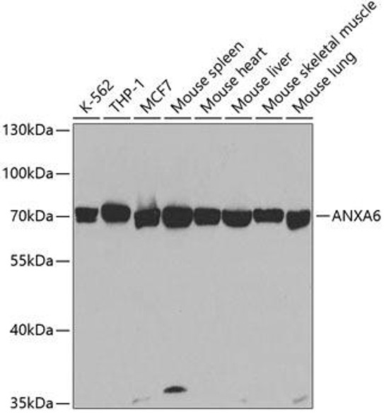 Anti-ANXA6 Antibody (CAB5390)