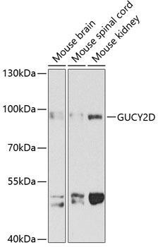 GUCY2D Rabbit Polyclonal Antibody (CAB3605)