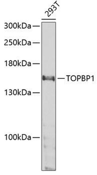 Anti-TOPBP1 Antibody (CAB5781)