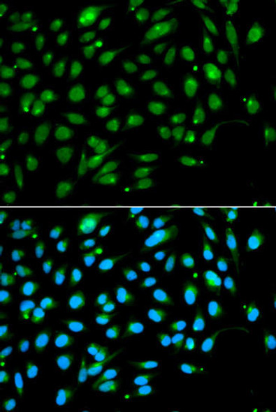 Anti-ING3 Antibody (CAB5832)