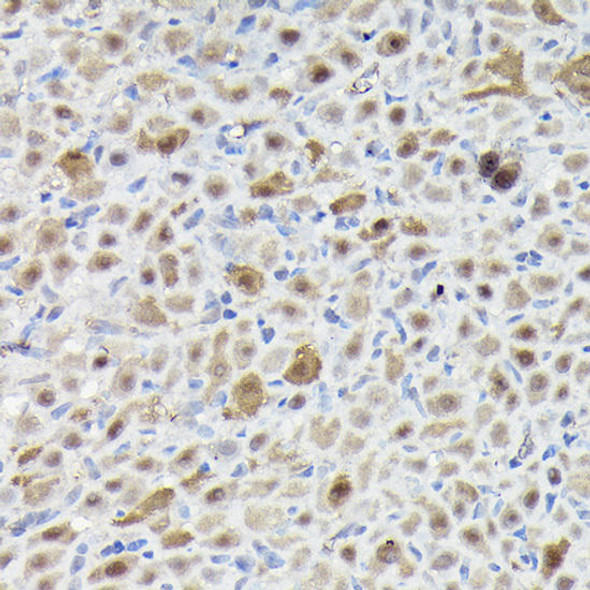 SNRPE Rabbit Polyclonal Antibody (CAB5488)