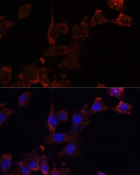 NRF1 Rabbit Polyclonal Antibody (CAB5547)