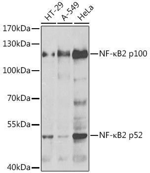 NF-κB2 Rabbit Polyclonal Antibody (CAB5567)