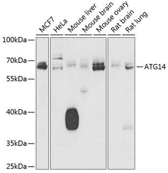 Anti-ATG14 Antibody (CAB7526)