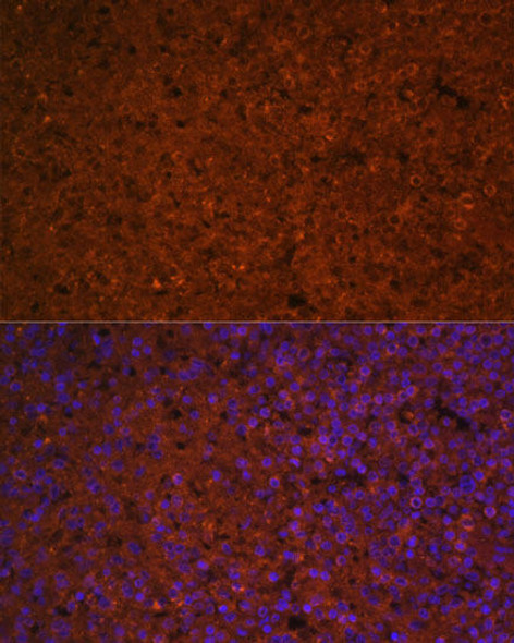 SLAMF7 Rabbit Polyclonal Antibody (CAB5782)