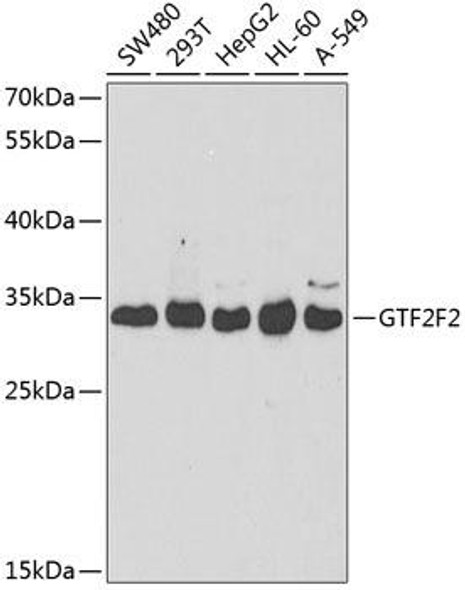 GTF2F2 Rabbit Polyclonal Antibody (CAB5826)