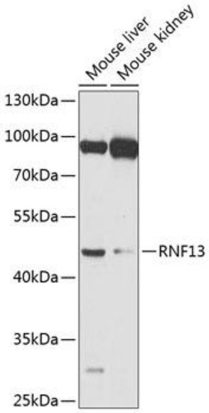 Anti-RNF13 Antibody (CAB8363)