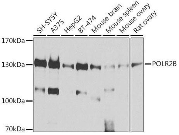 POLR2B Rabbit Polyclonal Antibody (CAB5928)