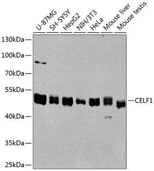 CELF1 Rabbit Polyclonal Antibody (CAB5958)