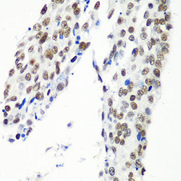 HTATSF1 Rabbit Polyclonal Antibody (CAB5977)