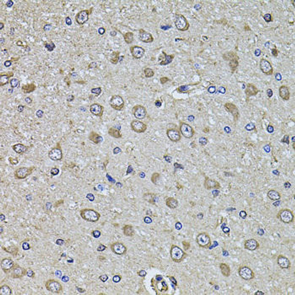 Anti-EPHA3 Antibody (CAB8414)