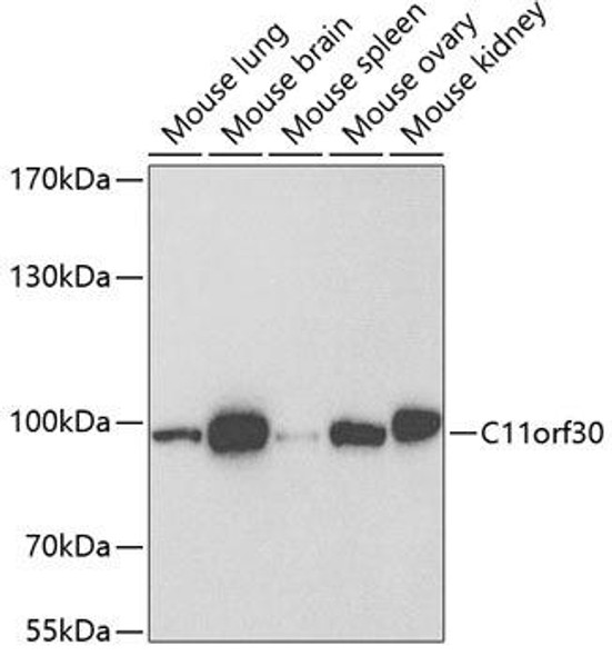 C11orf30 Rabbit Polyclonal Antibody (CAB6138)