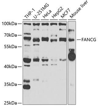 FANCG Rabbit Polyclonal Antibody (CAB6206)