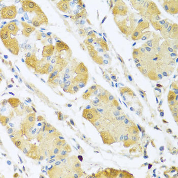 C4BPB Rabbit Polyclonal Antibody (CAB6362)