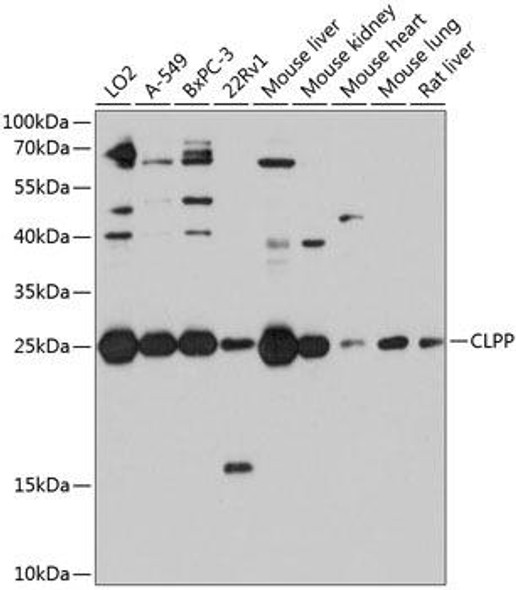 Anti-CLPP Antibody (CAB9127)