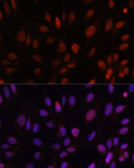 HOXB1 Rabbit Polyclonal Antibody (CAB6619)