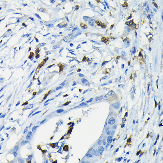 NFATC3 Rabbit Polyclonal Antibody (CAB6666)