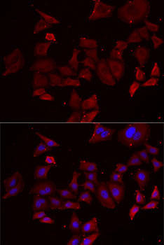 NPHP1 Rabbit Polyclonal Antibody (CAB6674)