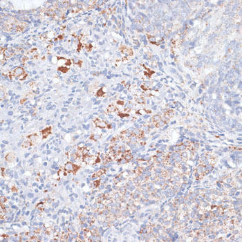 SMPD1/ASM Rabbit Polyclonal Antibody (CAB6743)