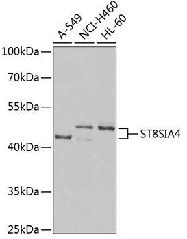 ST8SIA4 Rabbit Polyclonal Antibody (CAB6754)