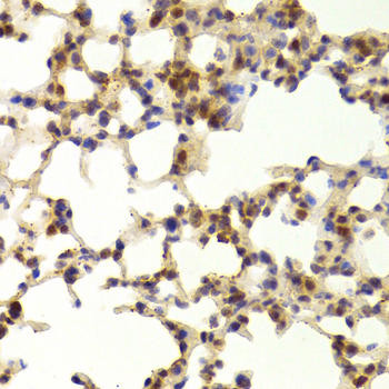 TAF1C Rabbit Polyclonal Antibody (CAB6759)