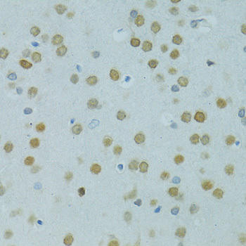 MUS81 Rabbit Polyclonal Antibody (CAB6818)