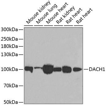 DACH1 Rabbit Polyclonal Antibody (CAB6895)