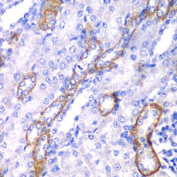 MYO1C Rabbit Polyclonal Antibody (CAB6936)