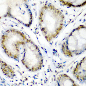 SS18 Rabbit Polyclonal Antibody (CAB6990)