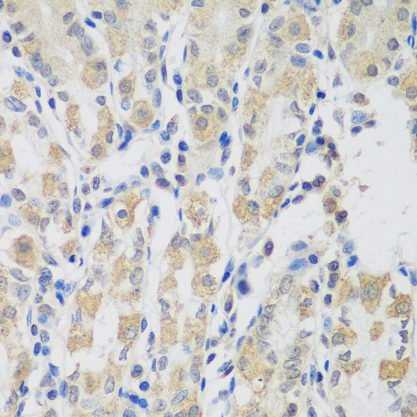 VPS4A Rabbit Polyclonal Antibody (CAB7096)
