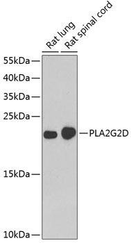PLA2G2D Rabbit Polyclonal Antibody (CAB7165)