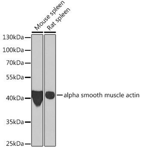 α-Smooth Muscle Actin (ACTA2) Rabbit Polyclonal Antibody (CAB7248)