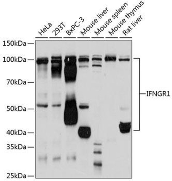 Anti-IFNGR1 Antibody (CAB11653)