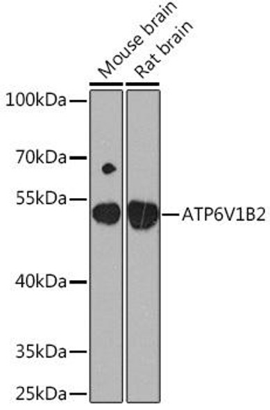 Anti-ATP6V1B2 Antibody (CAB16770)
