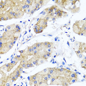 PSTPIP1 Rabbit Polyclonal Antibody (CAB7760)